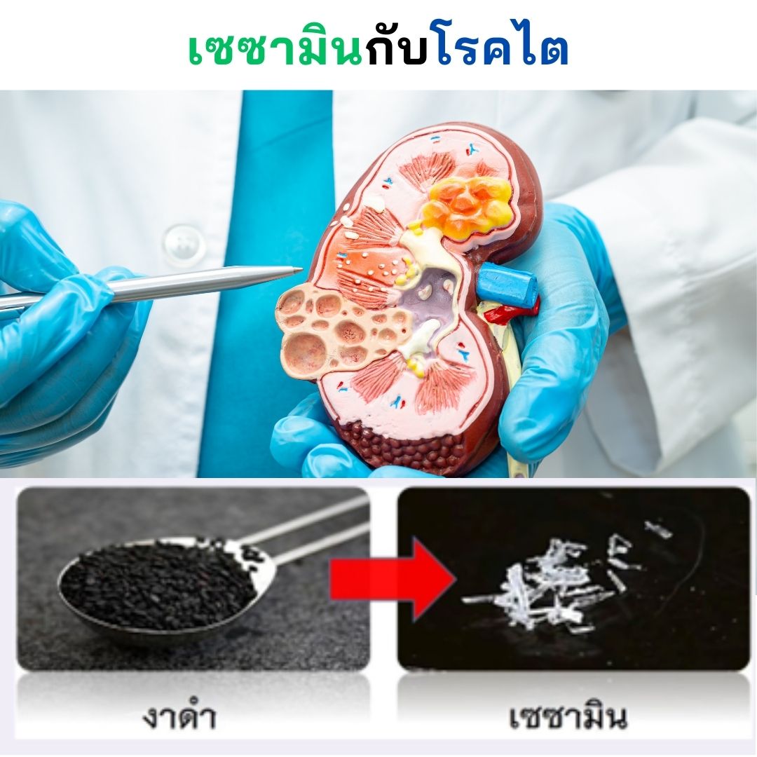 เซซามินกับโรคไต 1 เซซามินกับโรคไต 1